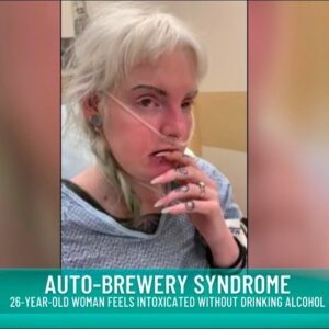 auto-brewery syndrome